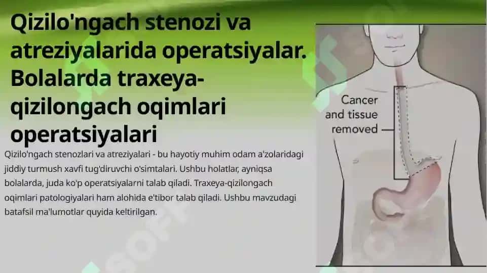 Qiziloʻngach stenozi va atreziyalarida operatsiya 3