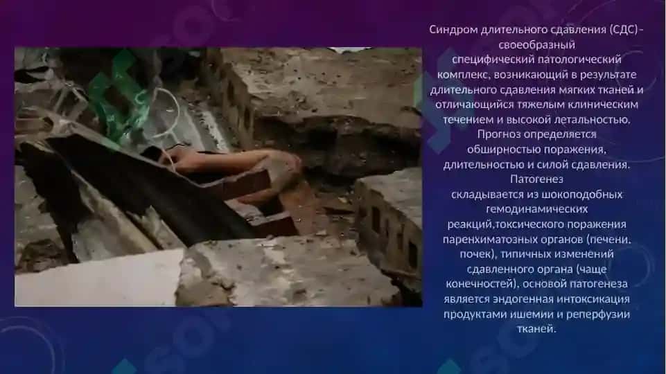 Синдром длительного сдавления (СДС) 2