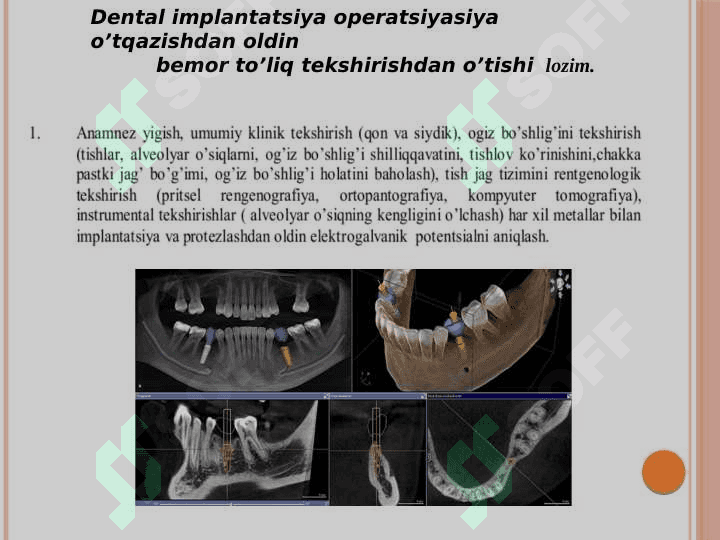Dental implantatsiya.Ko'rsatma va qarshi ko'rsatma 2