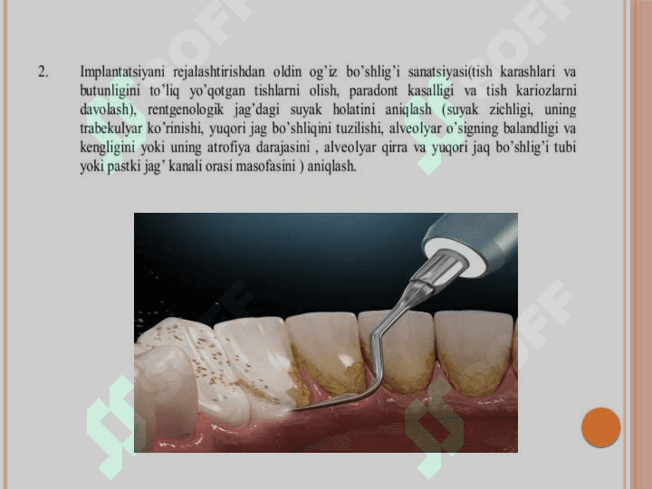 Dental implantatsiya.Ko'rsatma va qarshi ko'rsatma 3