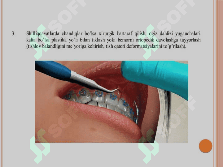 Dental implantatsiya.Ko'rsatma va qarshi ko'rsatma 4