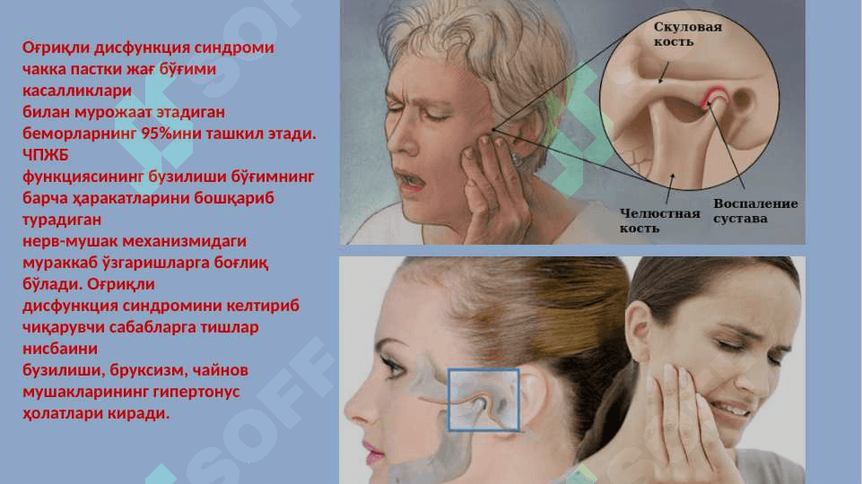 ChPJB ogʻriqli disfunksiya
 sindromi, osteoartroz 2
