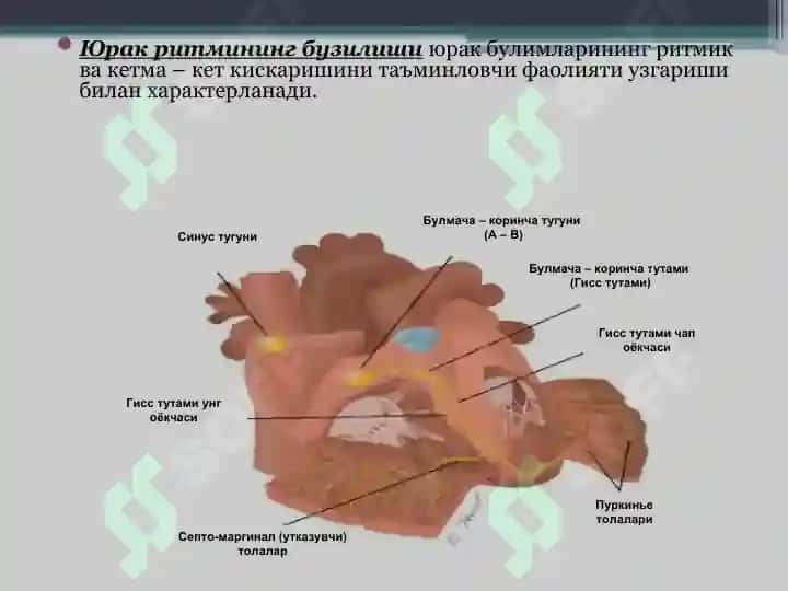 Юрак ритмининг бузилиши. Диагностика 2