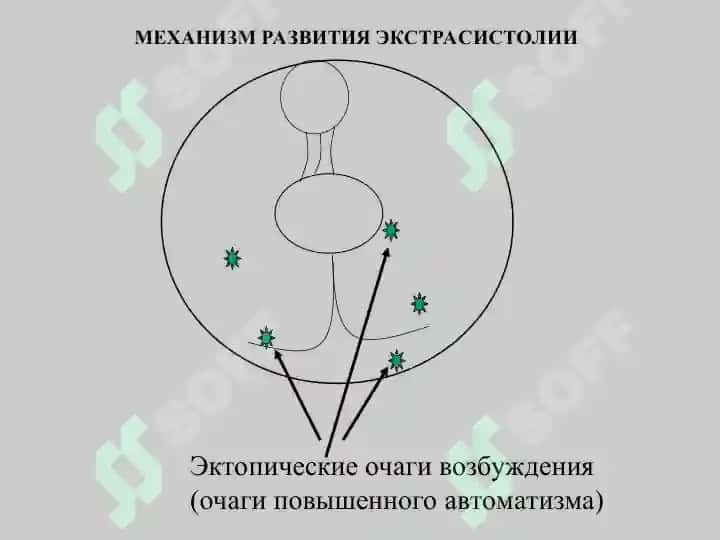 Противоаритмическое средство 6