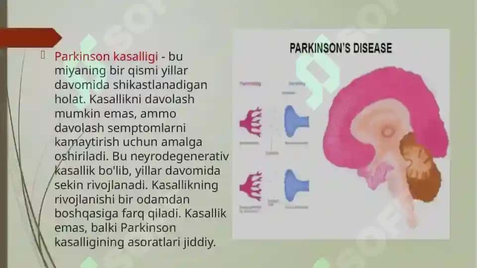 Parkinson kasalligini davolashda ishlatiladigan dori vositalar 5