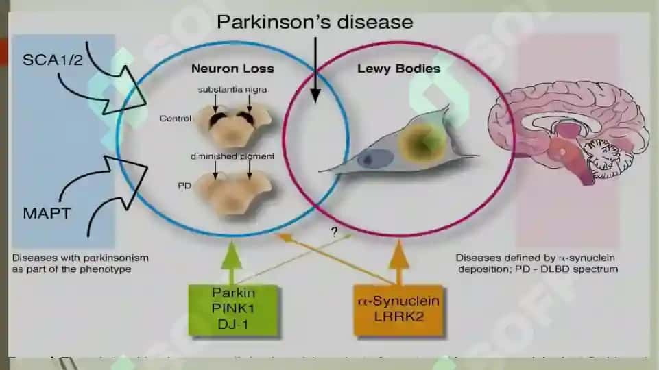 Parkinson kasalligini davolashda ishlatiladigan dori vositalar 8