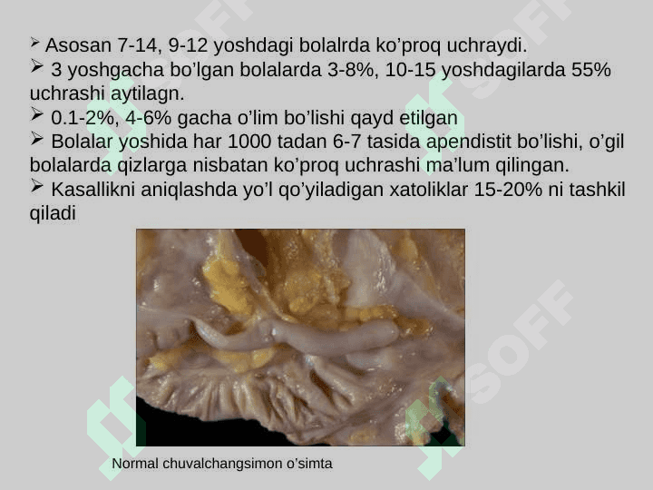 3 yoshgacha bo’lgan bolalarda o`tkir appenditsit 4