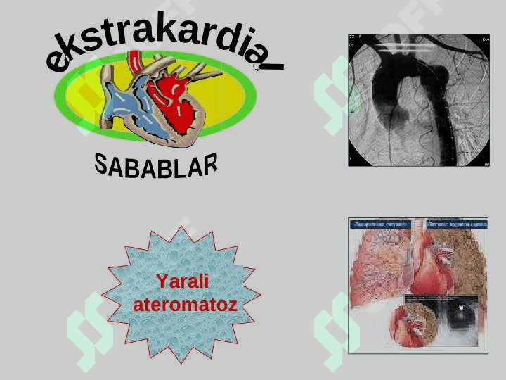 EMBOLIYA VA MAHALLIY ASORATLARI 6