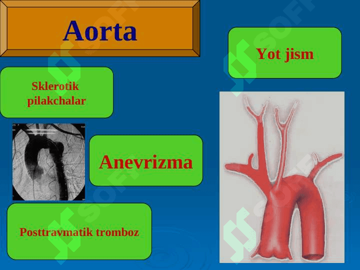 EMBOLIYA VA MAHALLIY ASORATLARI 8