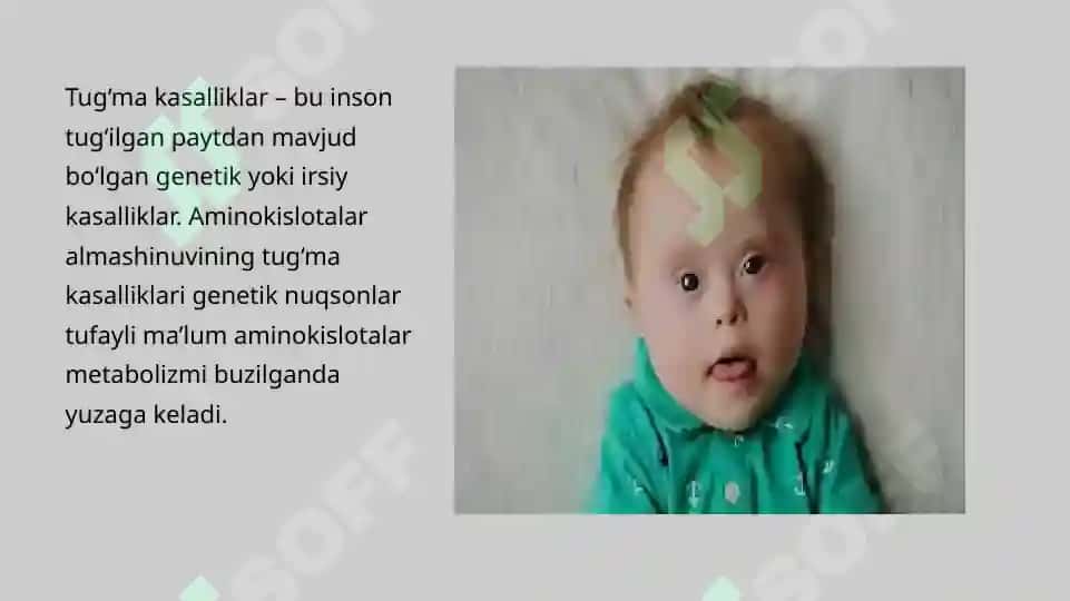 Aminokislotalar almashinuvining tug’ma kasalliklari 4