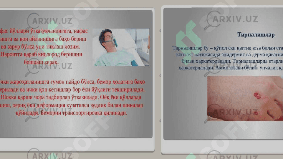 Kombinatsiyalashgan va qo‘shma jarohatlar 3