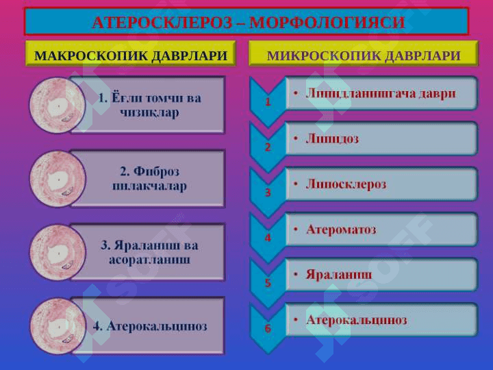 Атеросклероз. Гипертония касаллиги 5