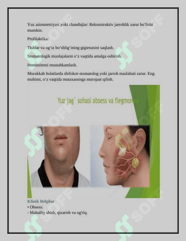 YUZ JAG‘ SOHASI ABSESS VA FLEGMONALARI ASORATLARINI DAVOLASH 3