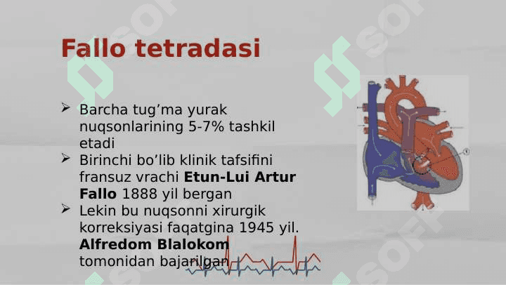 Yurakning tug'ma nuqsonlari 8