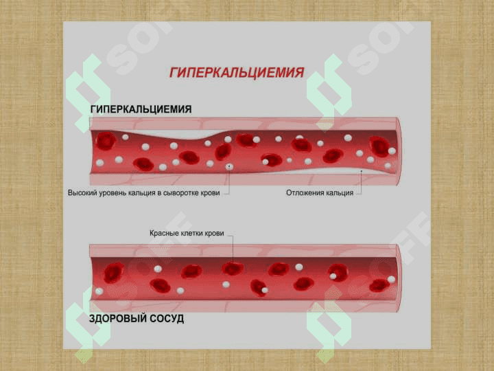 Mikroelementozlar ftor kalsiy miqdorlarining oshib ketishi 4