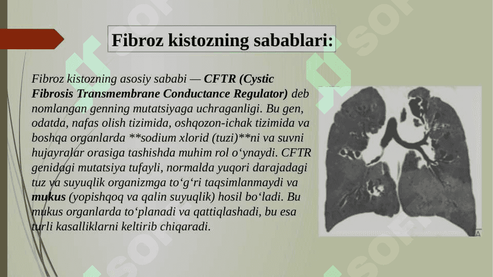 Genlarning o’zgarishi bilan bogʻliq irsiy kasalliklar 5
