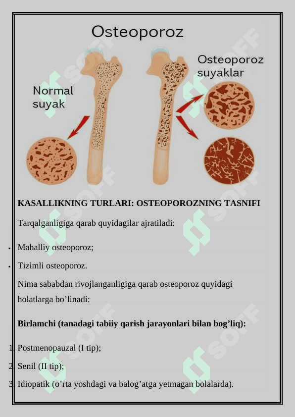 Osteoporozlar ratsional terapiyasining tamoyillari 4