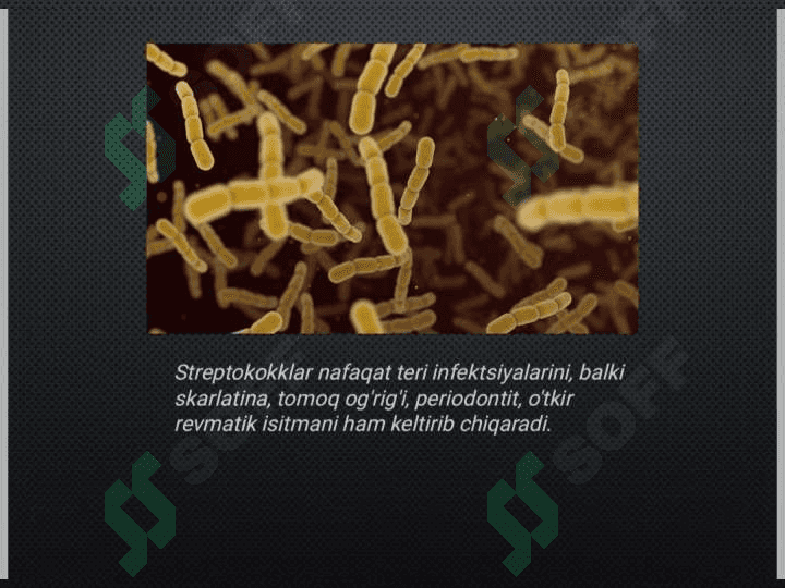 Og'iz atrofi
yiringli piodermiyasi 4