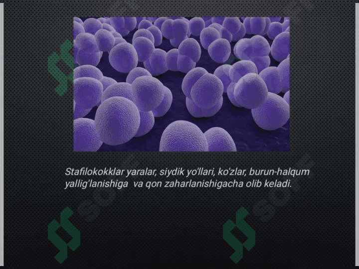Og'iz atrofi
yiringli piodermiyasi 5