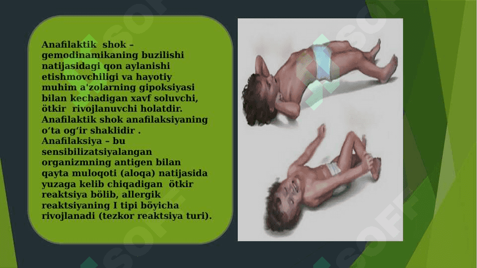 Anafilaktik Shok 2