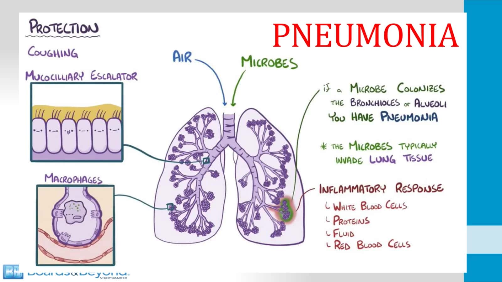 Lobar Pneumonia 1
