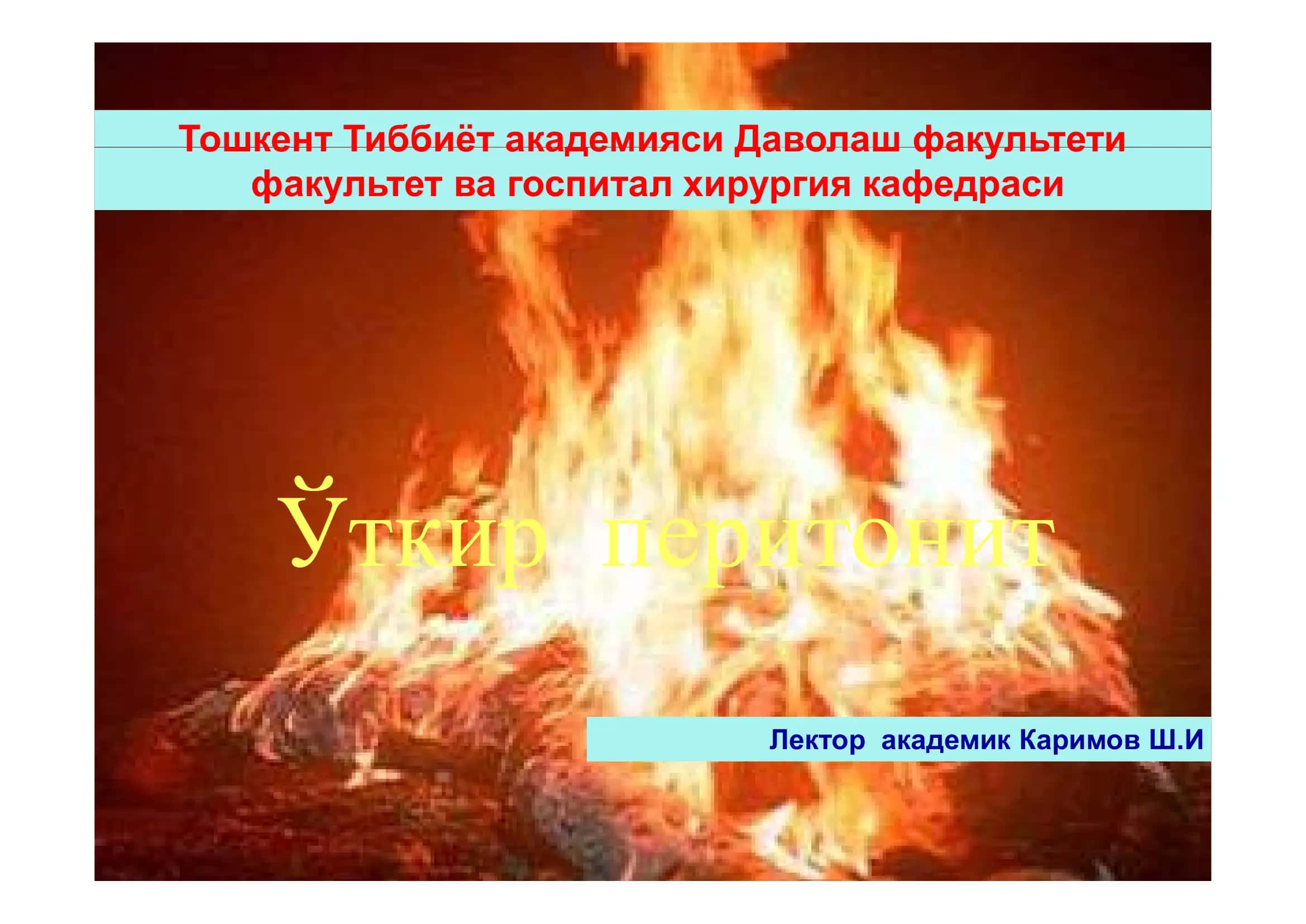 Ўткир перитонит 1