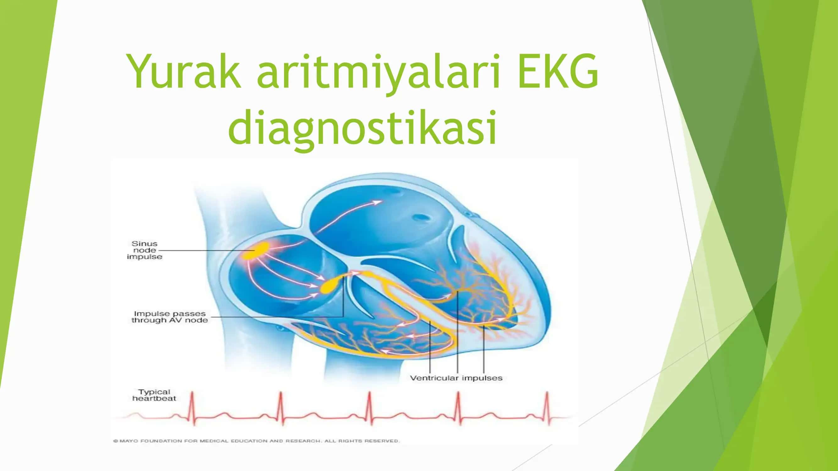 Yurak aritmiyalari EKG diagnostikasi 1