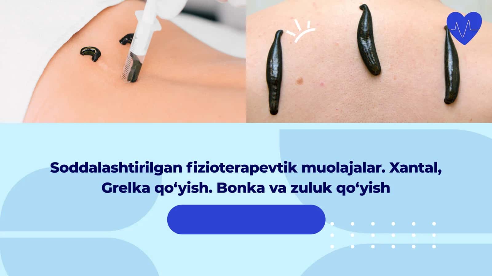 Fizioterapevtik muolajalar 1