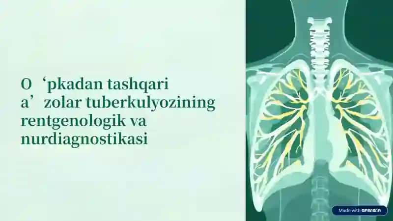 O'pkadan tashqari tuberkulyozning Rentgenologik va nurdiagnostikasi