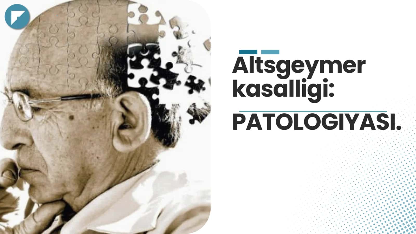 Altsgeymer kasalligi patologiyasi 1