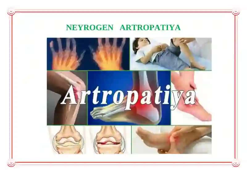 Neyrogen Artropatiya