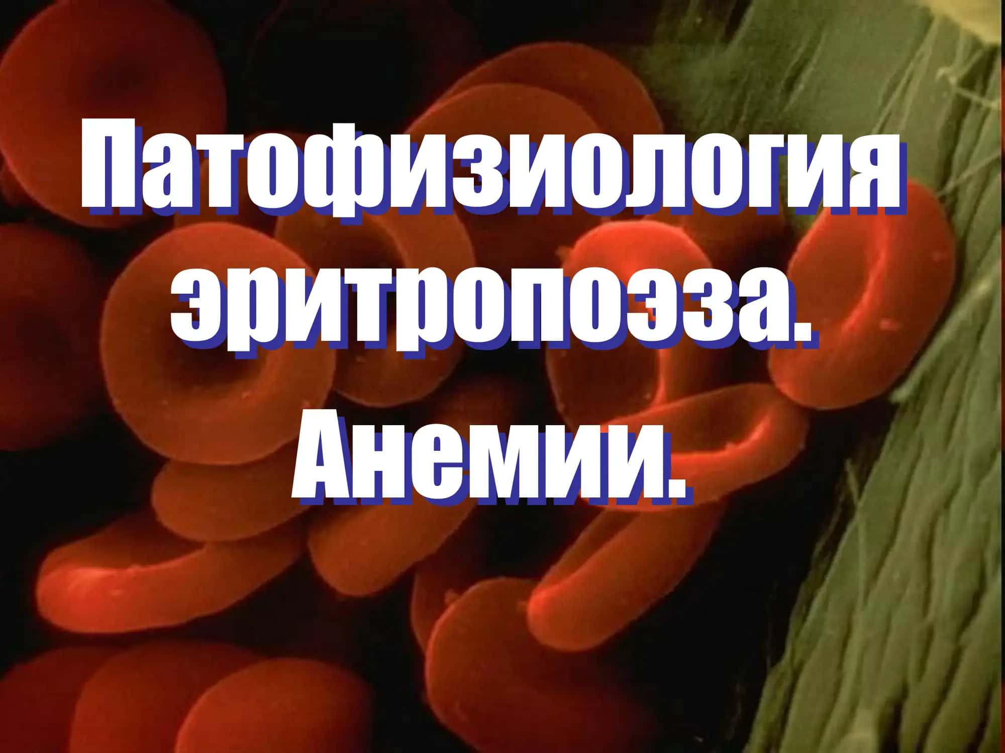 Патофизиология  эритропоэза.  Анемии. 1