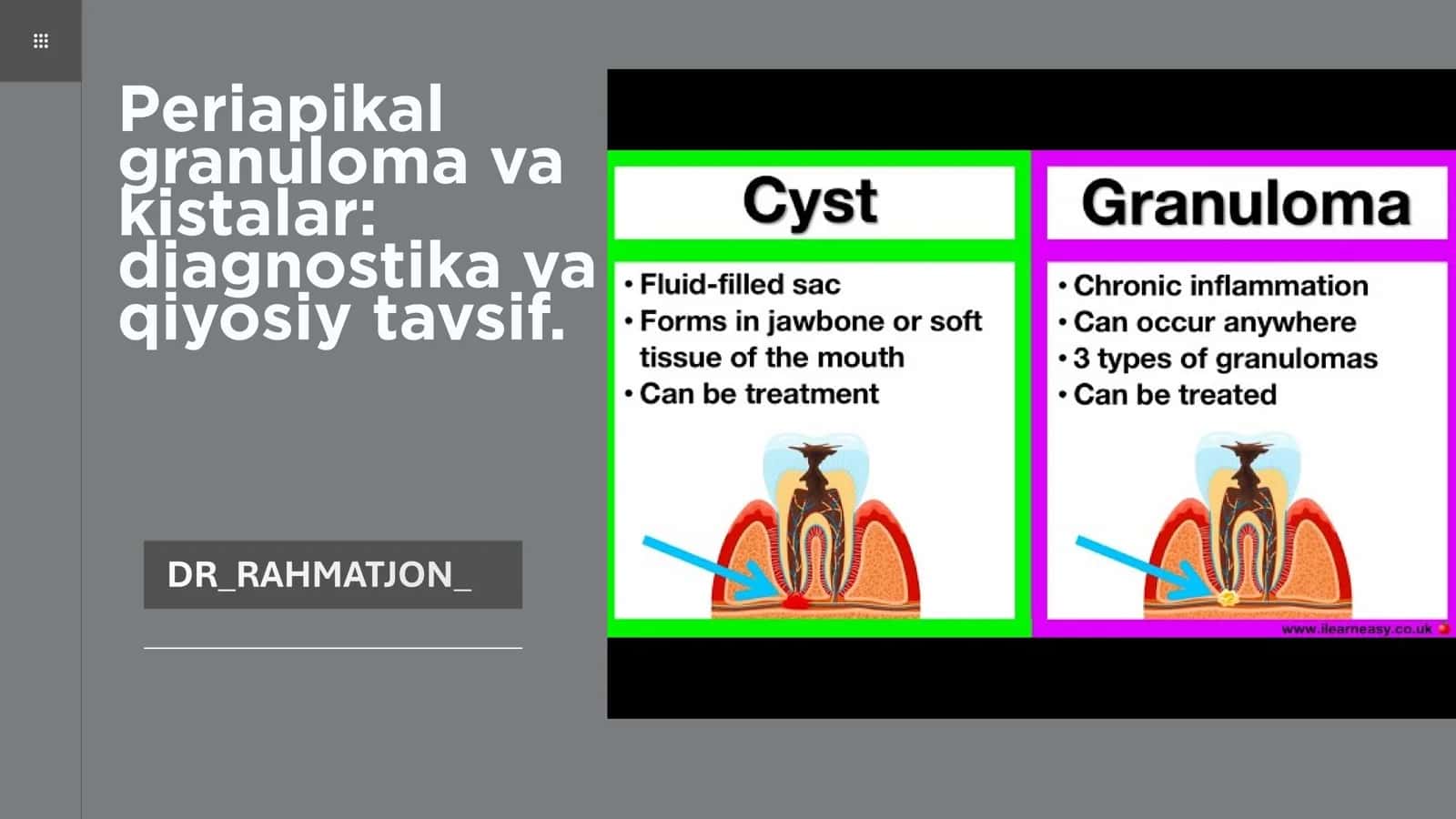 Periapikal granuloma va kistalar: diagnostika va qiyosiy tavsif 1