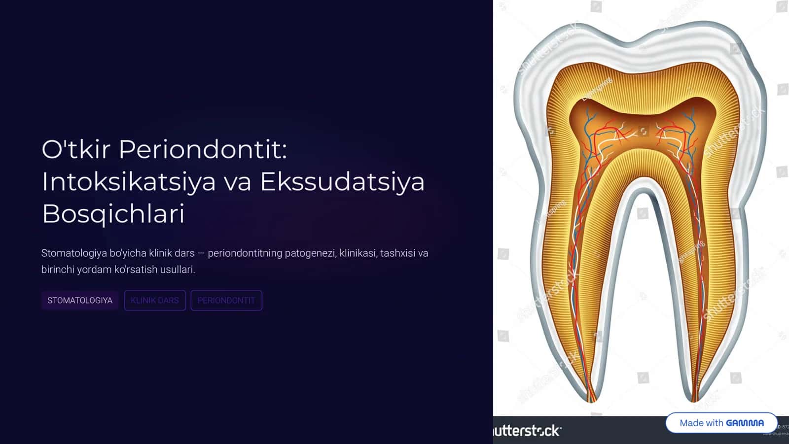 Otkir periodontit 1