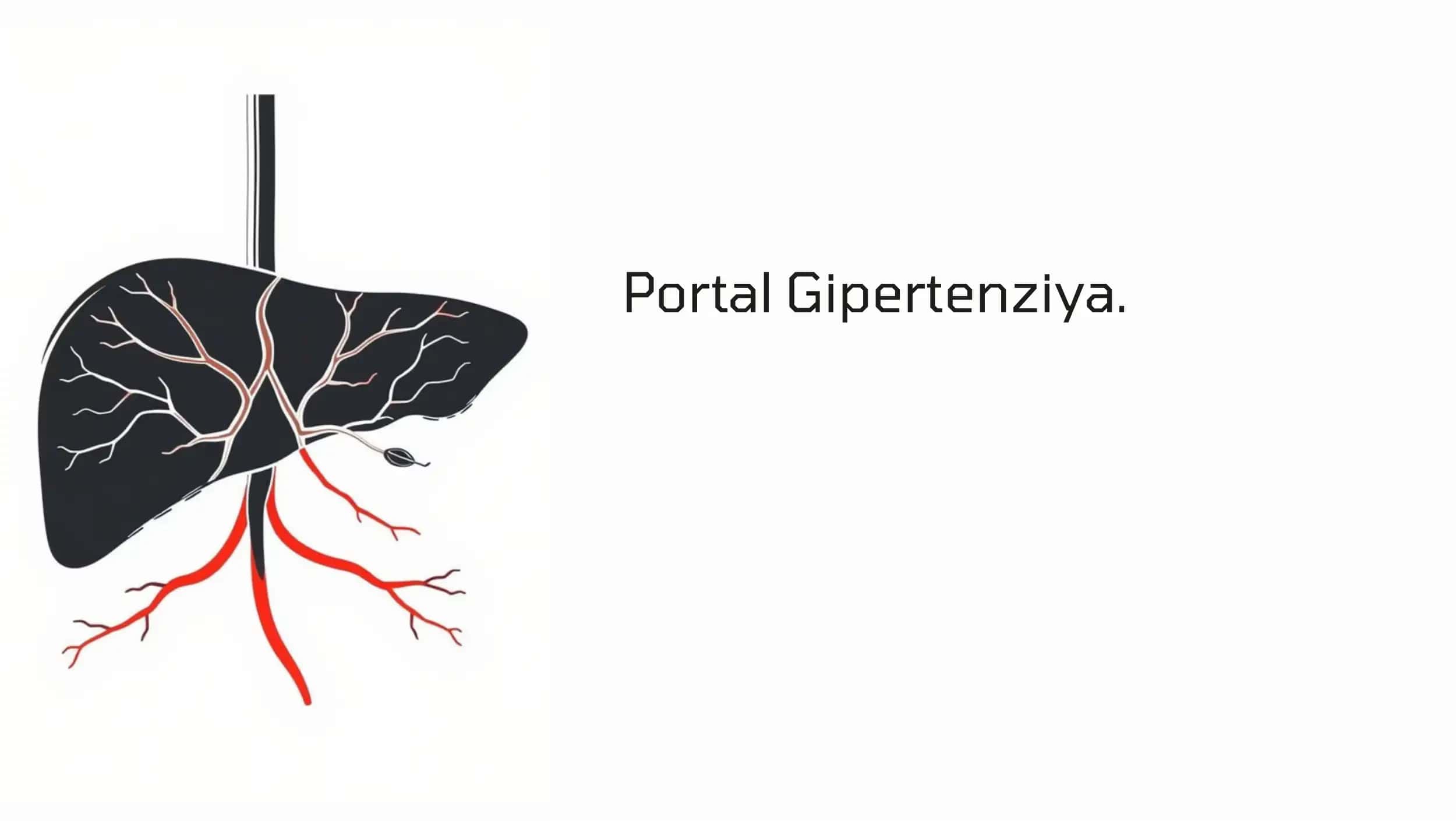 Portal Gipertenziya 1