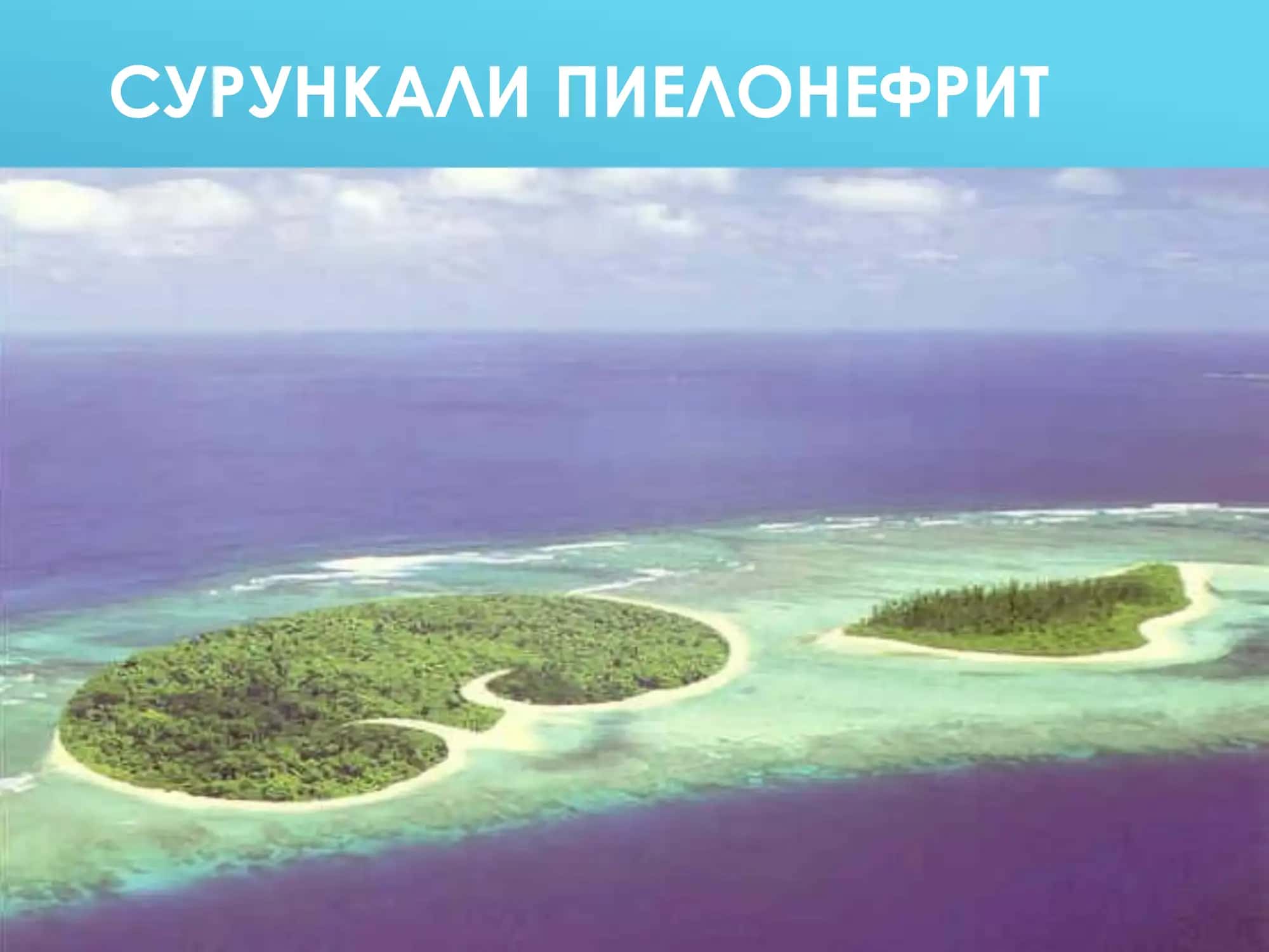 СУРУНКАЛИ ПИЕЛОНЕФРИТ 1