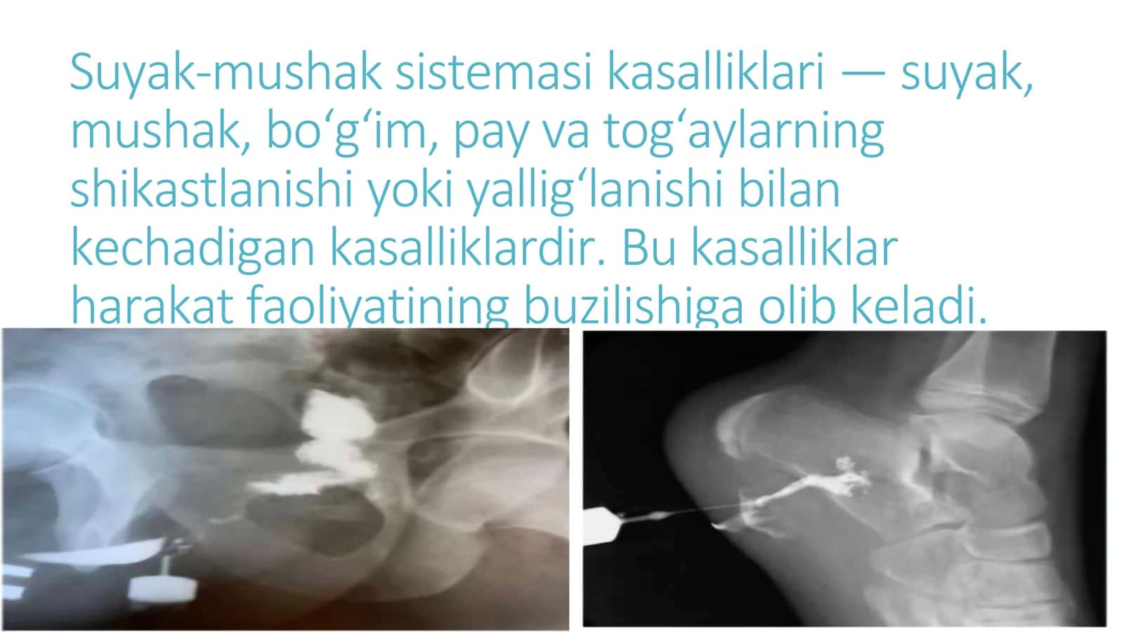 Suyak mushak sistemalari 2