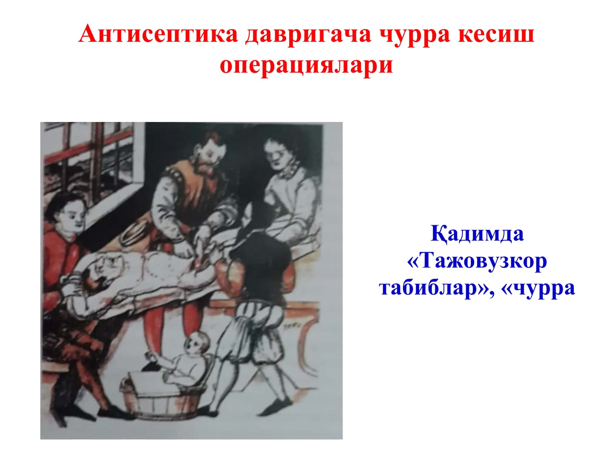 Қорин чурралари 2