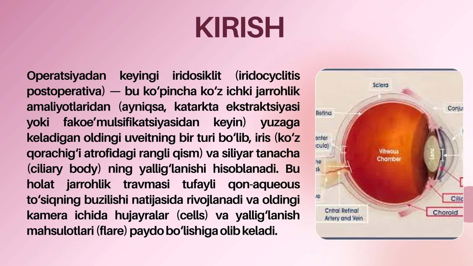 Operatsiyadan keyingi Iridosiklit 2