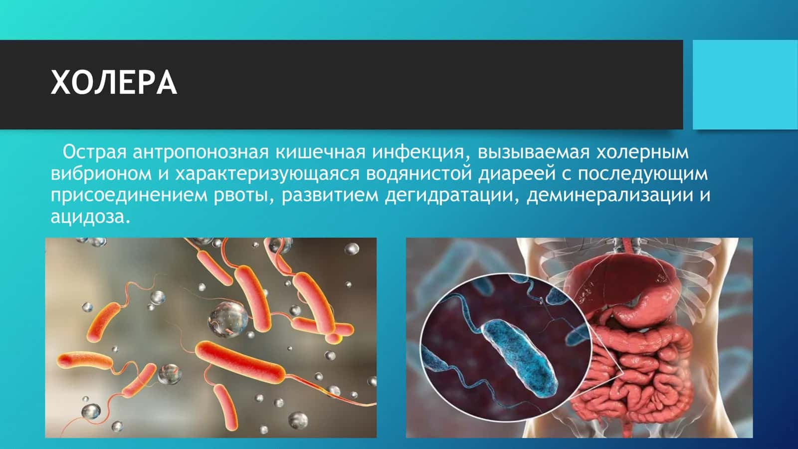 Тема: ХОЛЕРА 2