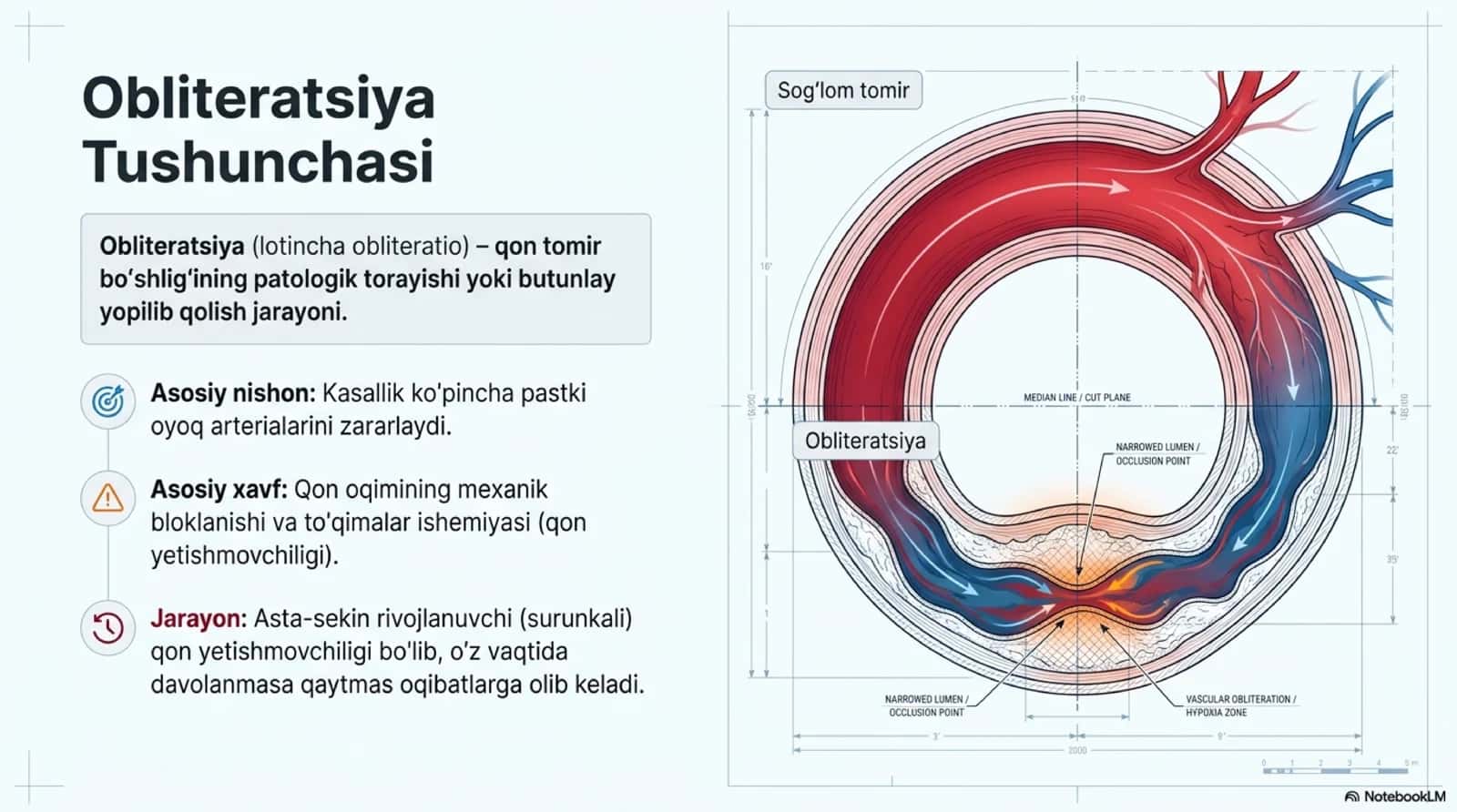 Obliteratsiyalovchi tomir kasalliklari 2