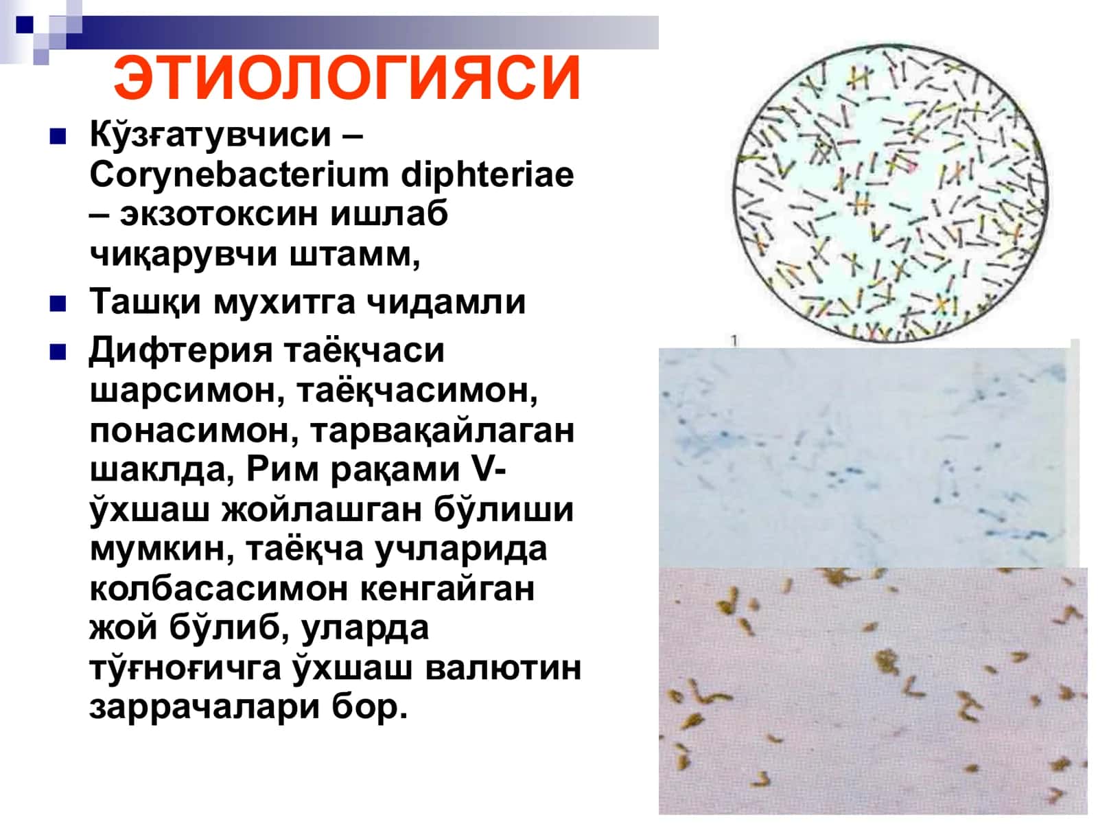 БЎҒМА – ДИФТЕРИЯ 2