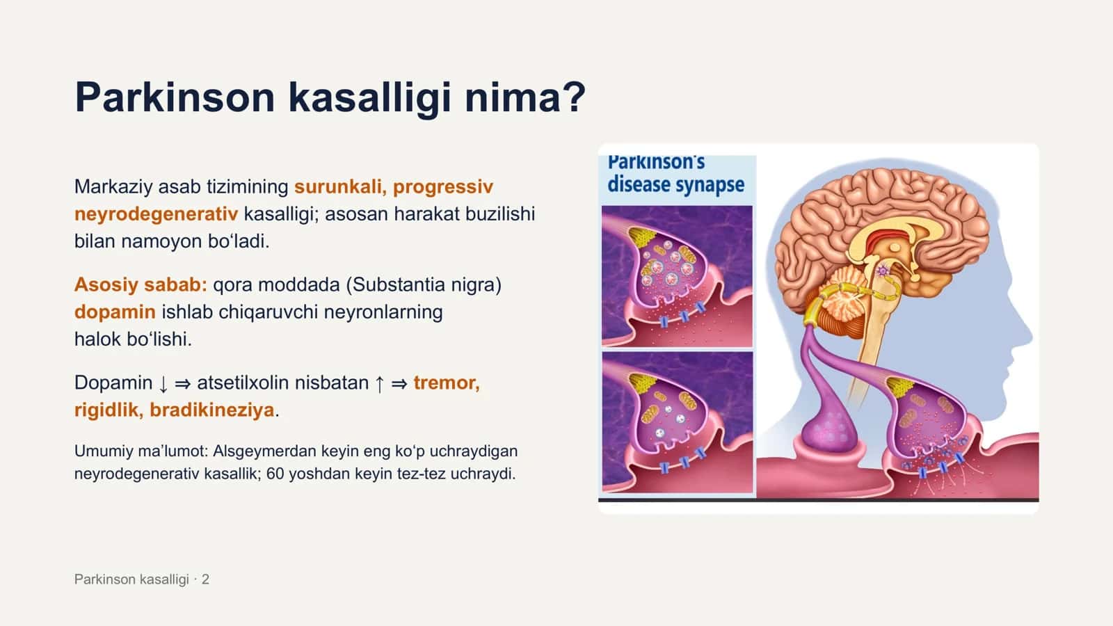 Parkinson kasalligi 2