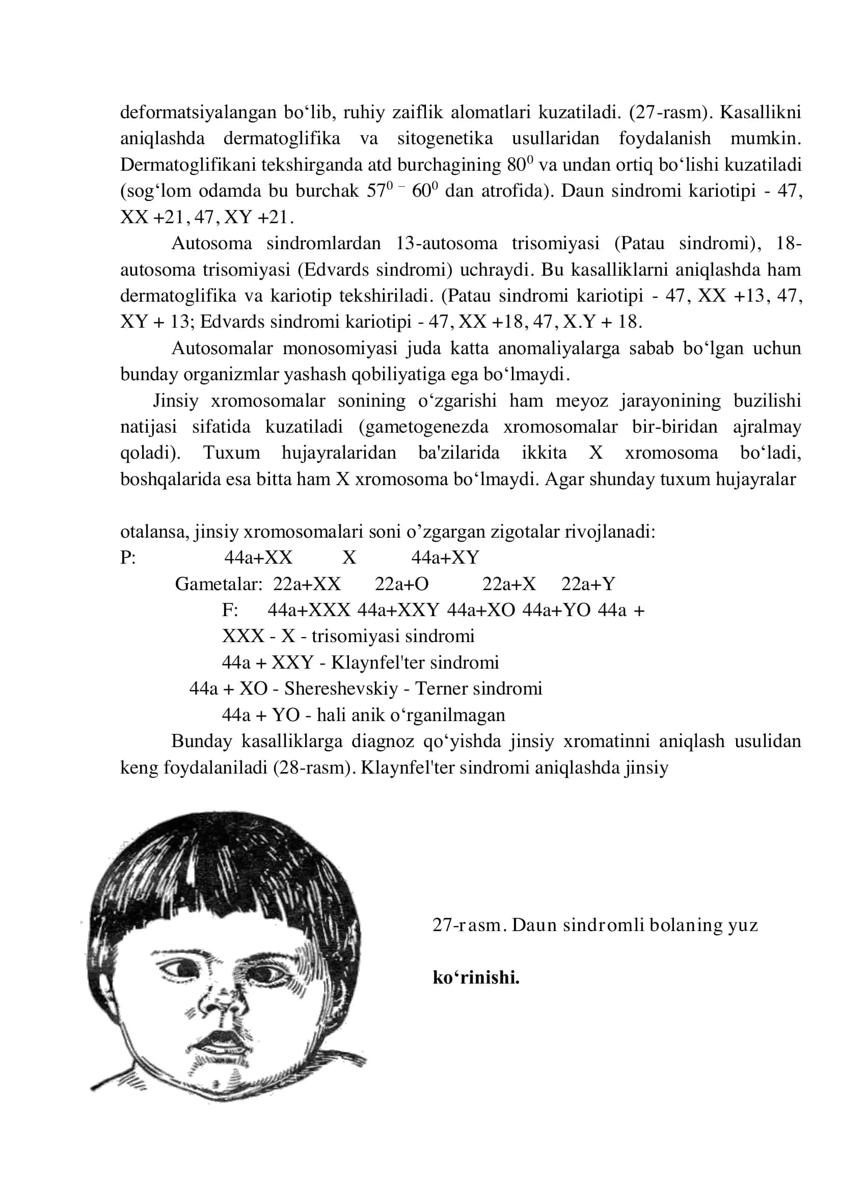 IRSIY KASALLIKLAR. XROMOSOMA KASALLIKLARI 2