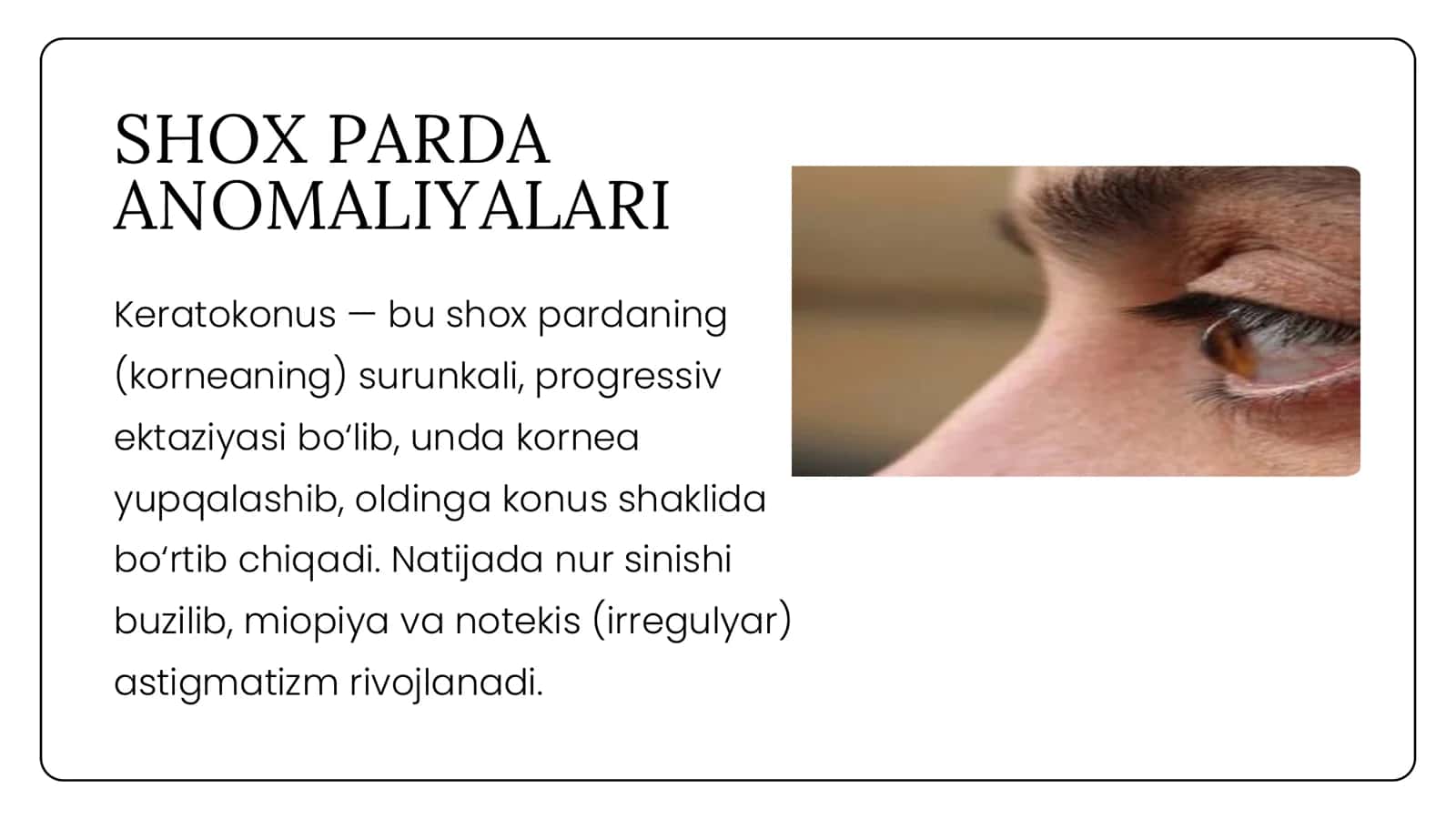 SHOX PARDA ANOMALIYALARI 2