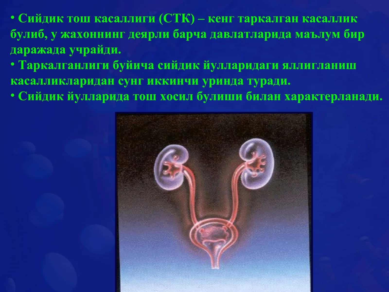 Сийдик тош касаллиги (СТК) 2