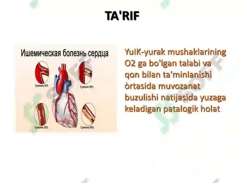 Yurak ishemik kasalliklari 2