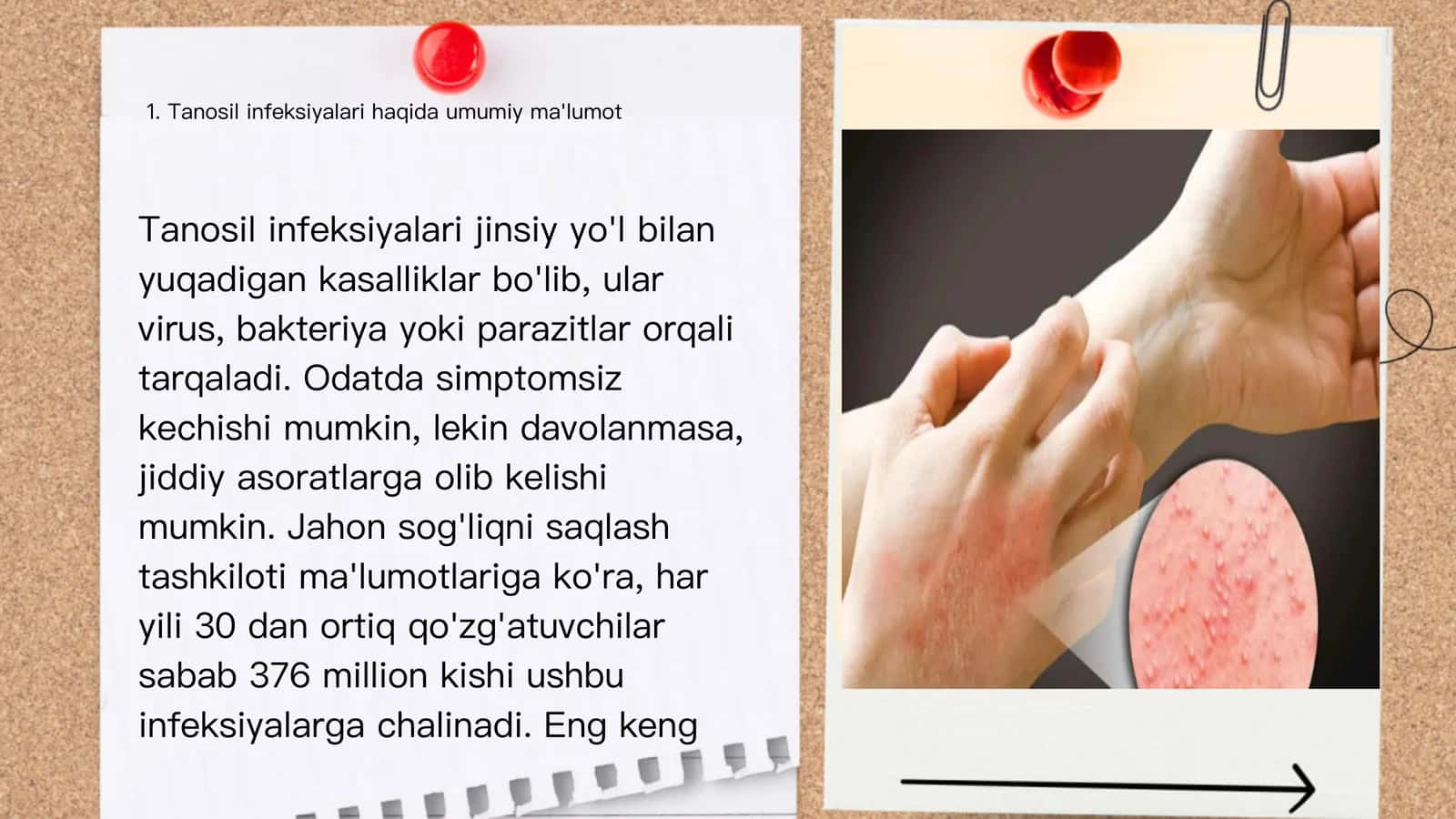Teri – Tanosil 3