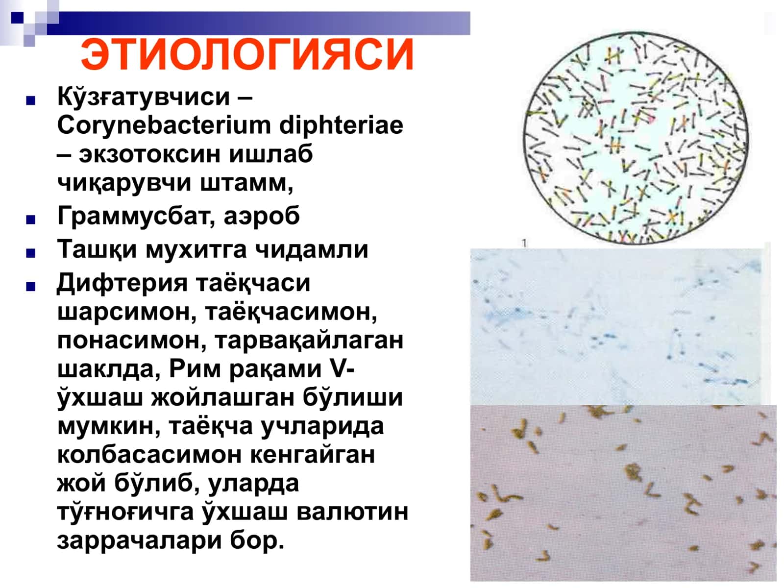 БЎҒМА – ДИФТЕРИЯ 3