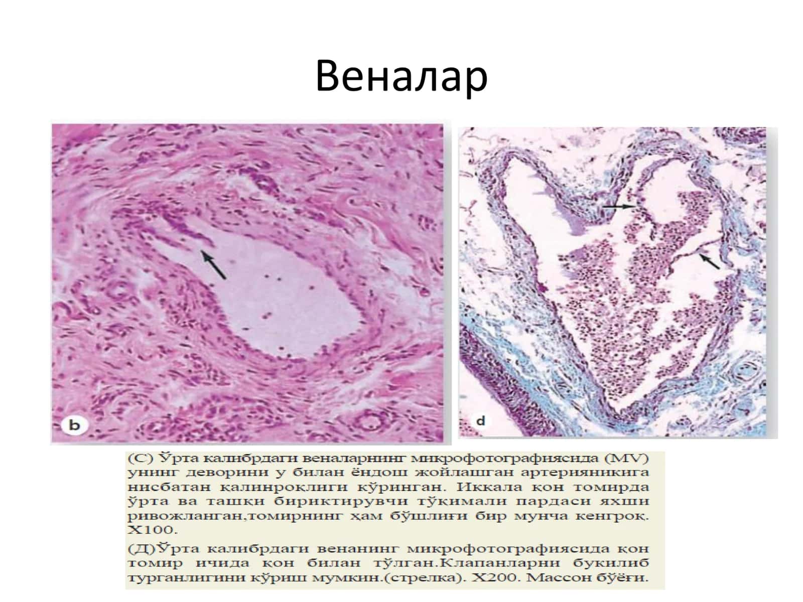 Юрак, вена ва лимфа томирлари 3